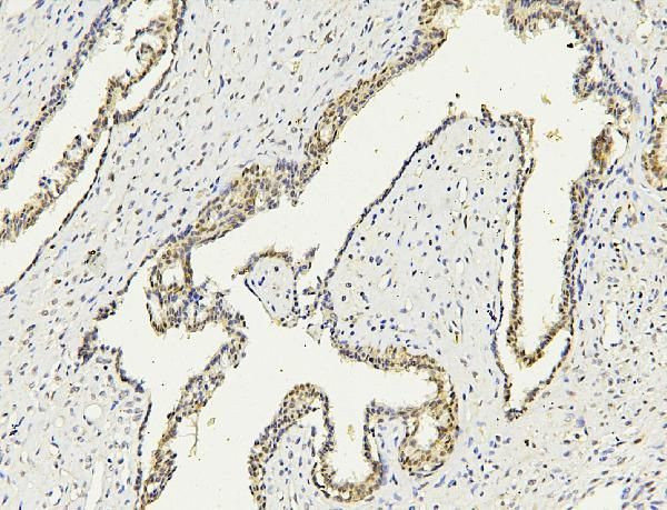 PARN Antibody in Immunohistochemistry (Paraffin) (IHC (P))