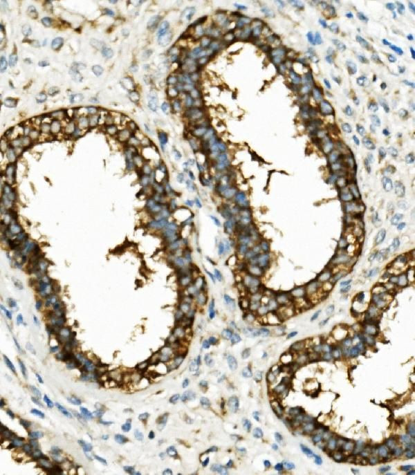 HK1 Antibody in Immunohistochemistry (Paraffin) (IHC (P))