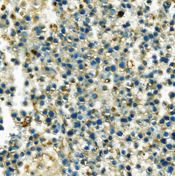 HK1 Antibody in Immunohistochemistry (Paraffin) (IHC (P))