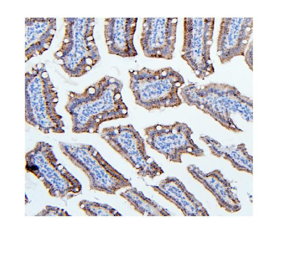 HK1 Antibody in Immunohistochemistry (Paraffin) (IHC (P))