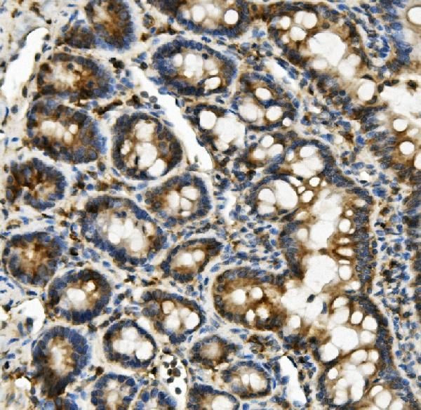 HK1 Antibody in Immunohistochemistry (Paraffin) (IHC (P))