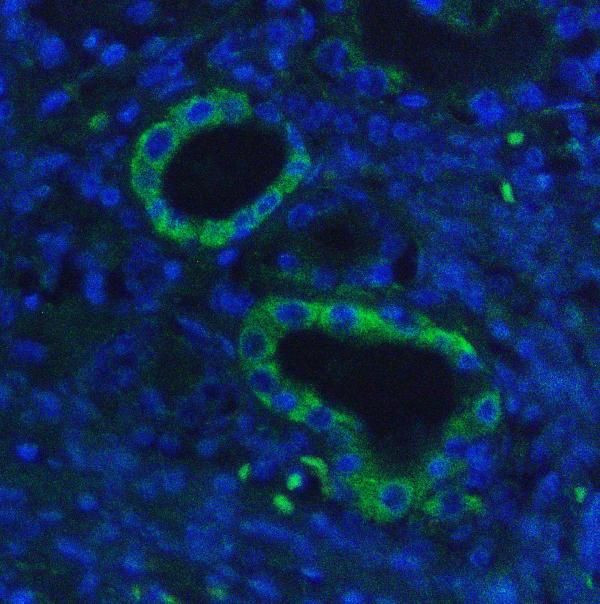 HK1 Antibody in Immunohistochemistry (Paraffin) (IHC (P))