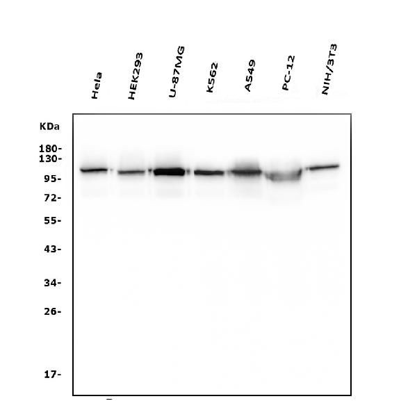 HK1 Antibody in Western Blot (WB)