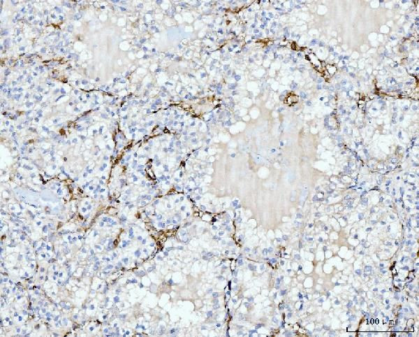 FABP4 Antibody in Immunohistochemistry (Paraffin) (IHC (P))