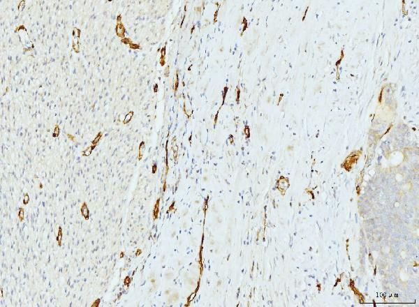 FABP4 Antibody in Immunohistochemistry (Paraffin) (IHC (P))