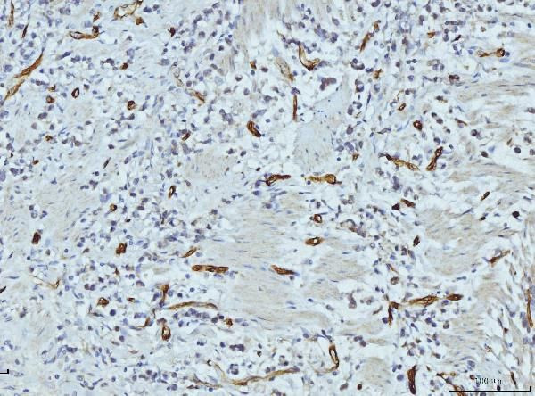 FABP4 Antibody in Immunohistochemistry (Paraffin) (IHC (P))