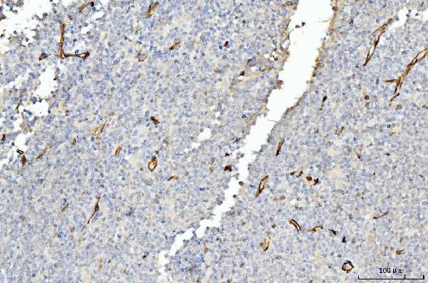 FABP4 Antibody in Immunohistochemistry (Paraffin) (IHC (P))