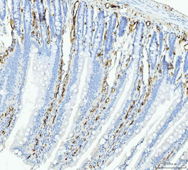 FABP4 Antibody in Immunohistochemistry (Paraffin) (IHC (P))