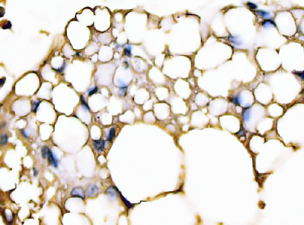 FABP4 Antibody in Immunohistochemistry (Paraffin) (IHC (P))