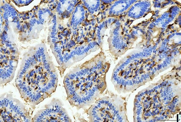 FABP4 Antibody in Immunohistochemistry (Paraffin) (IHC (P))