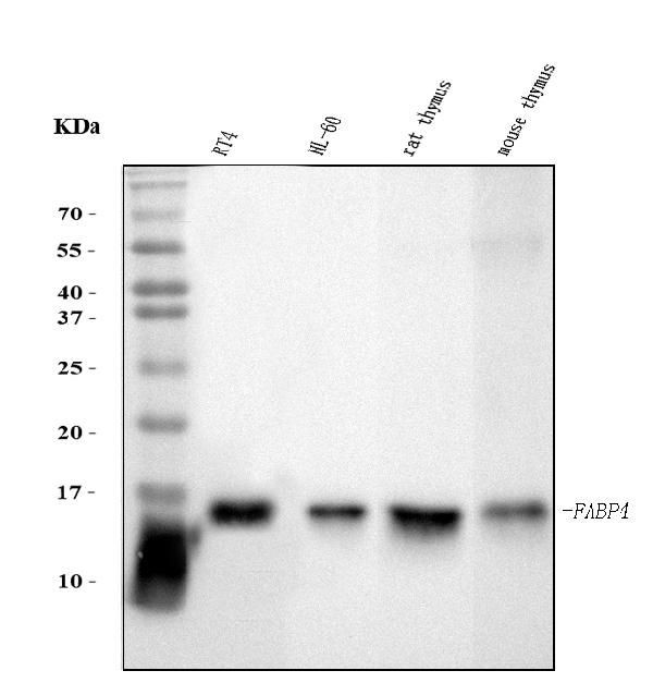 FABP4 Antibody in Western Blot (WB)