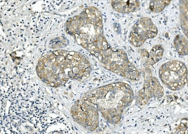 BUBR1 Antibody in Immunohistochemistry (Paraffin) (IHC (P))