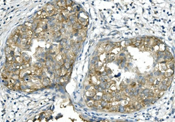 BUBR1 Antibody in Immunohistochemistry (Paraffin) (IHC (P))