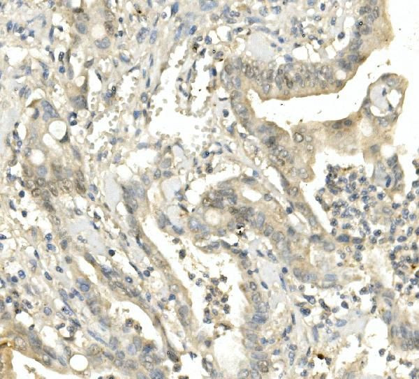 BUBR1 Antibody in Immunohistochemistry (Paraffin) (IHC (P))