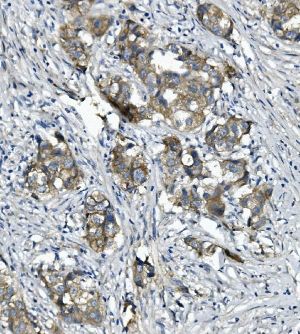 Catenin alpha-1 Antibody in Immunohistochemistry (Paraffin) (IHC (P))