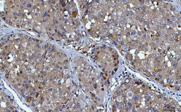 14-3-3 epsilon Antibody in Immunohistochemistry (Paraffin) (IHC (P))