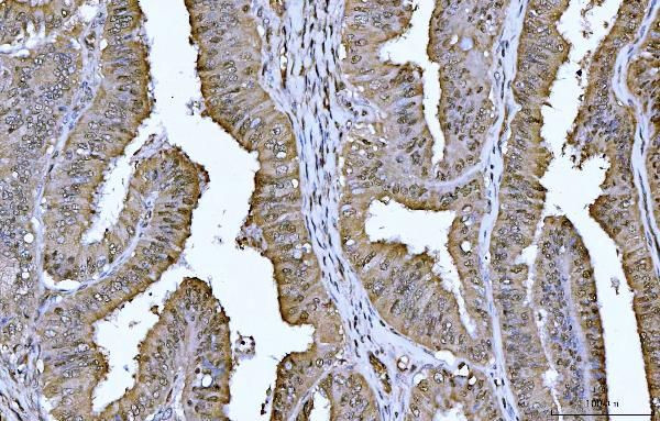 14-3-3 epsilon Antibody in Immunohistochemistry (Paraffin) (IHC (P))