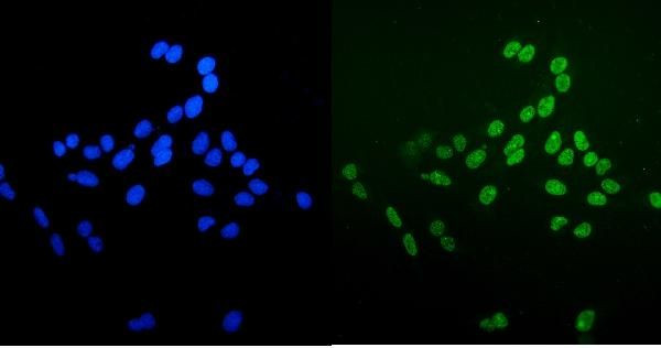 Ku70 Antibody in Immunocytochemistry (ICC/IF)