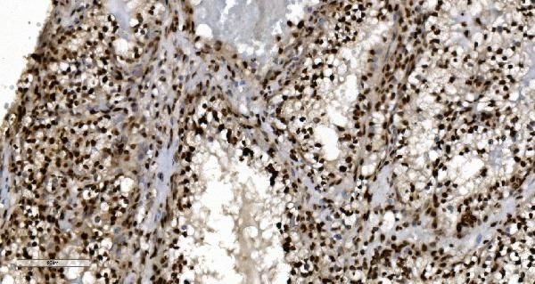 Ku70 Antibody in Immunohistochemistry (Paraffin) (IHC (P))