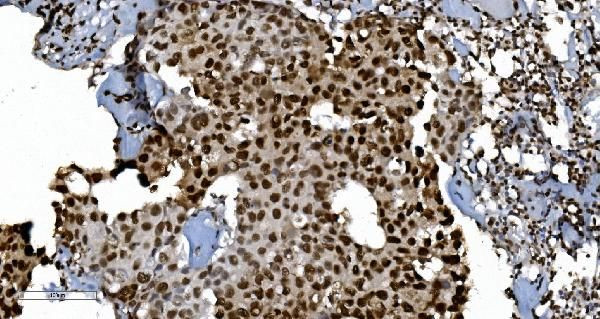 Ku70 Antibody in Immunohistochemistry (Paraffin) (IHC (P))