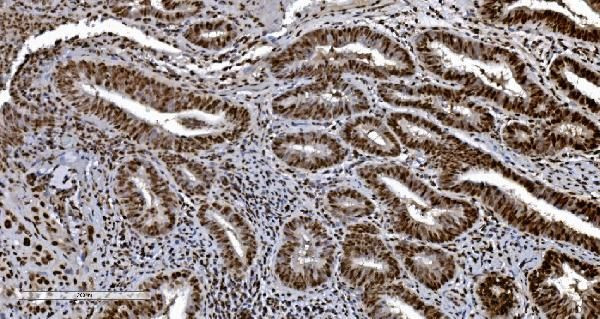 Ku70 Antibody in Immunohistochemistry (Paraffin) (IHC (P))