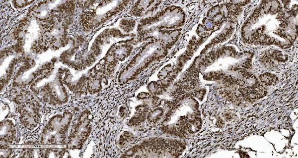 Ku70 Antibody in Immunohistochemistry (Paraffin) (IHC (P))