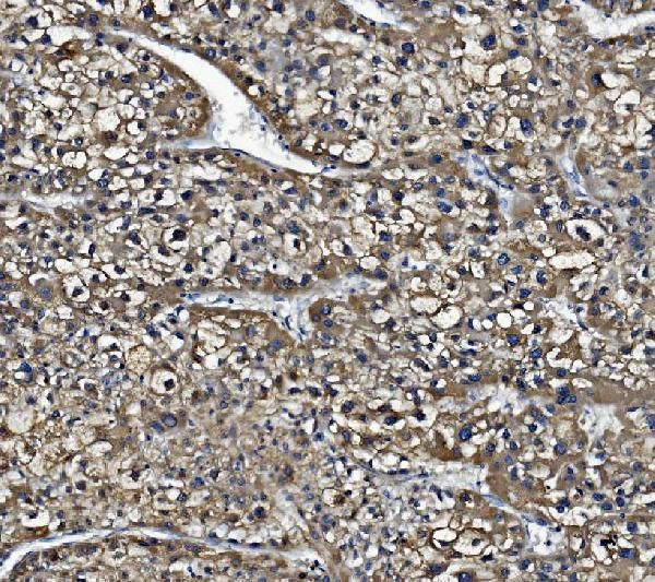 CES1 Antibody in Immunohistochemistry (Paraffin) (IHC (P))