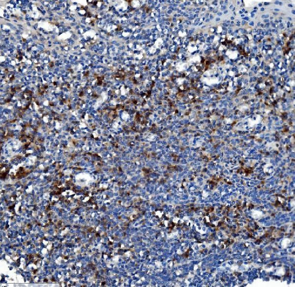 CES1 Antibody in Immunohistochemistry (Paraffin) (IHC (P))