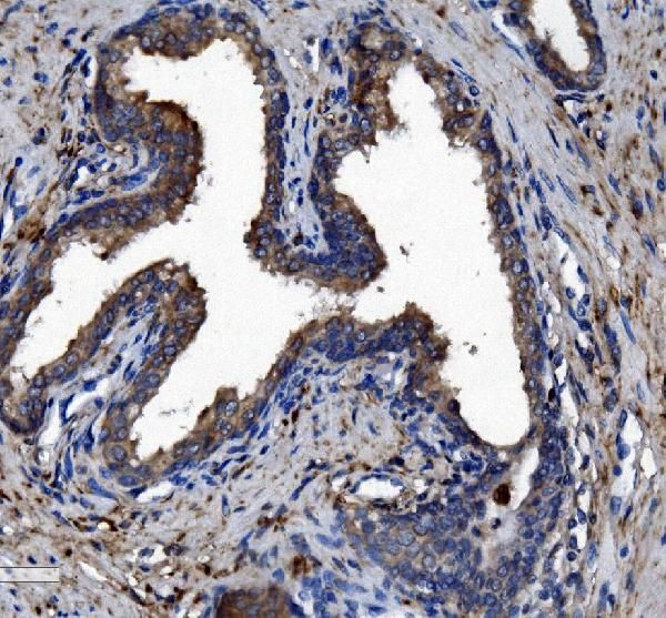 CES1 Antibody in Immunohistochemistry (Paraffin) (IHC (P))