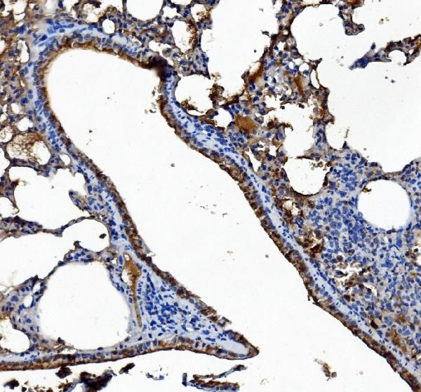 CES1 Antibody in Immunohistochemistry (Paraffin) (IHC (P))