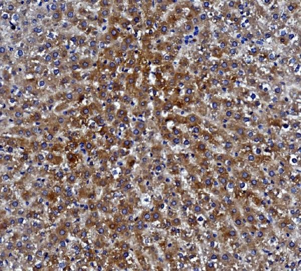 CES1 Antibody in Immunohistochemistry (Paraffin) (IHC (P))