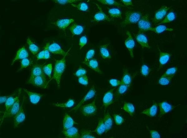 SHIP2 Antibody in Immunocytochemistry (ICC/IF)