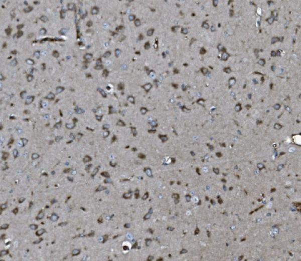 SHIP2 Antibody in Immunohistochemistry (Paraffin) (IHC (P))