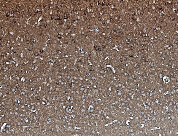 PP2A alpha Antibody in Immunohistochemistry (Paraffin) (IHC (P))