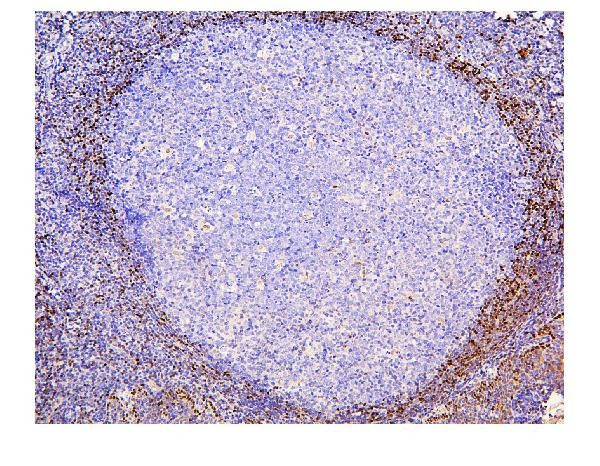 ADK Antibody in Immunohistochemistry (Paraffin) (IHC (P))