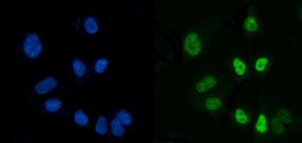 CtBP2 Antibody in Immunocytochemistry (ICC/IF)