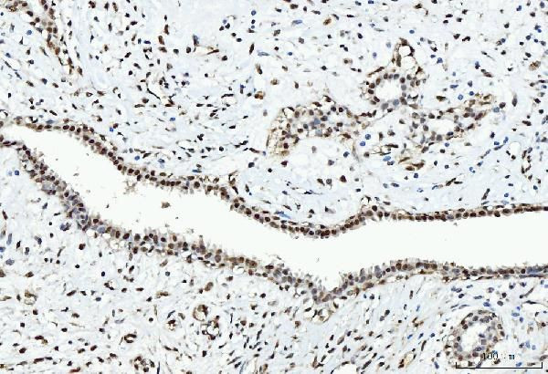 CtBP2 Antibody in Immunohistochemistry (Paraffin) (IHC (P))