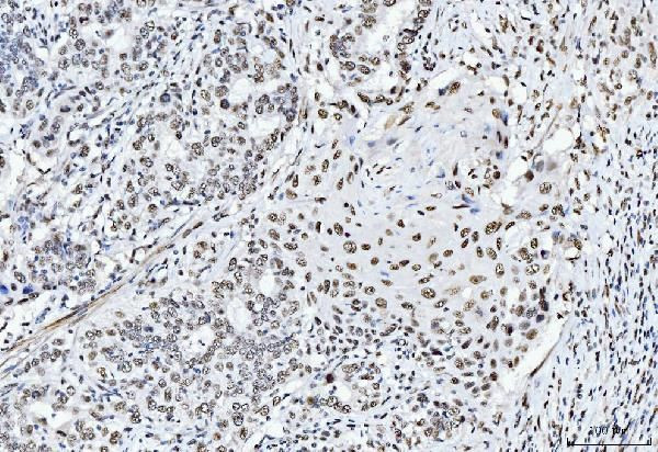 CtBP2 Antibody in Immunohistochemistry (Paraffin) (IHC (P))