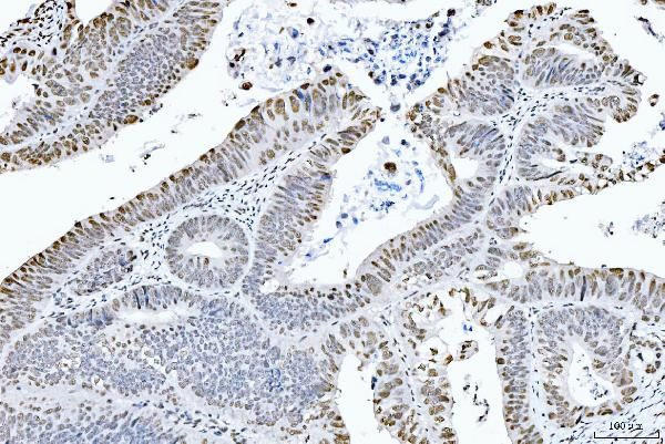 CtBP2 Antibody in Immunohistochemistry (Paraffin) (IHC (P))