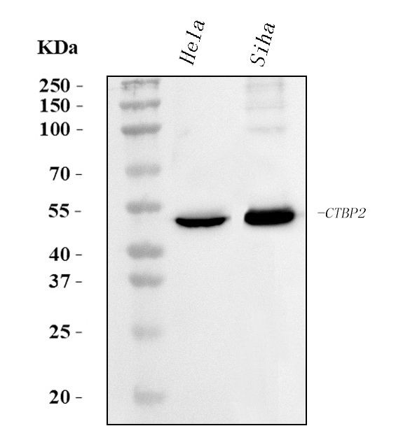 CtBP2 Antibody in Western Blot (WB)