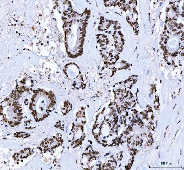 CtBP2 Antibody in Immunohistochemistry (Paraffin) (IHC (P))