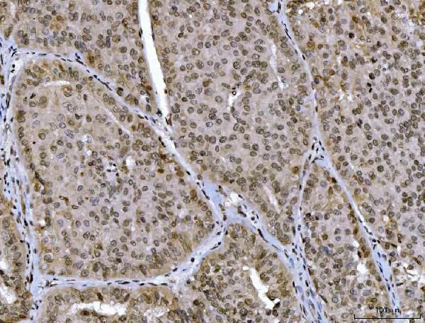 CtBP2 Antibody in Immunohistochemistry (Paraffin) (IHC (P))