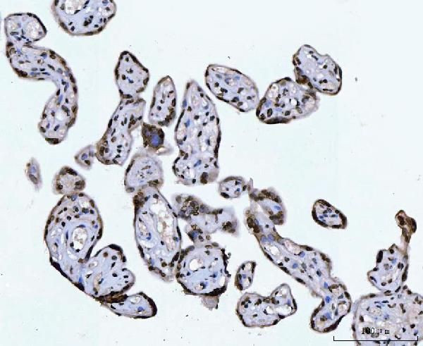 CtBP2 Antibody in Immunohistochemistry (Paraffin) (IHC (P))