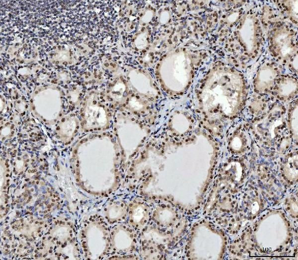 CtBP2 Antibody in Immunohistochemistry (Paraffin) (IHC (P))