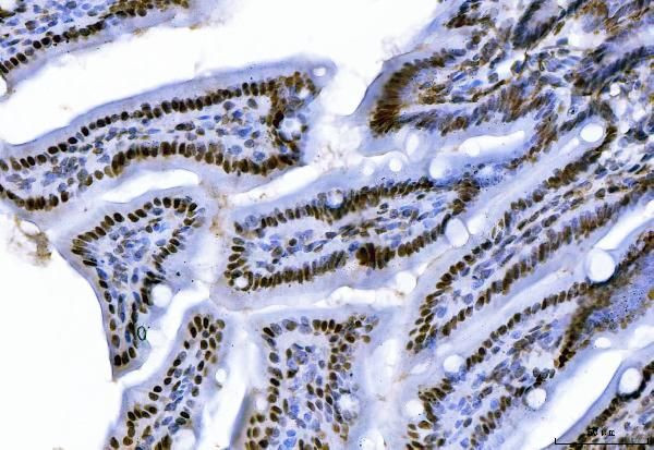 CtBP2 Antibody in Immunohistochemistry (Paraffin) (IHC (P))