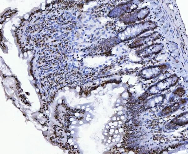 CtBP2 Antibody in Immunohistochemistry (Paraffin) (IHC (P))