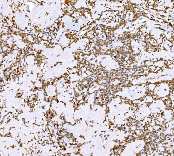 SND1 Antibody in Immunohistochemistry (Paraffin) (IHC (P))