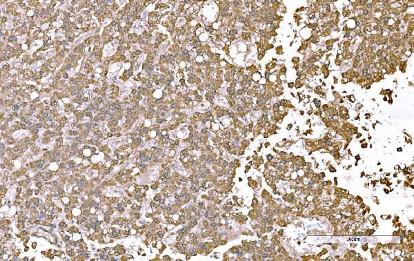 SND1 Antibody in Immunohistochemistry (Paraffin) (IHC (P))