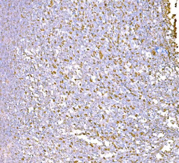 SND1 Antibody in Immunohistochemistry (Paraffin) (IHC (P))