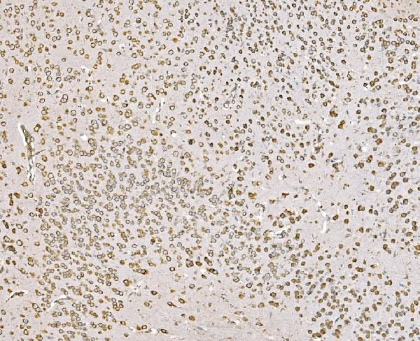 SND1 Antibody in Immunohistochemistry (Paraffin) (IHC (P))